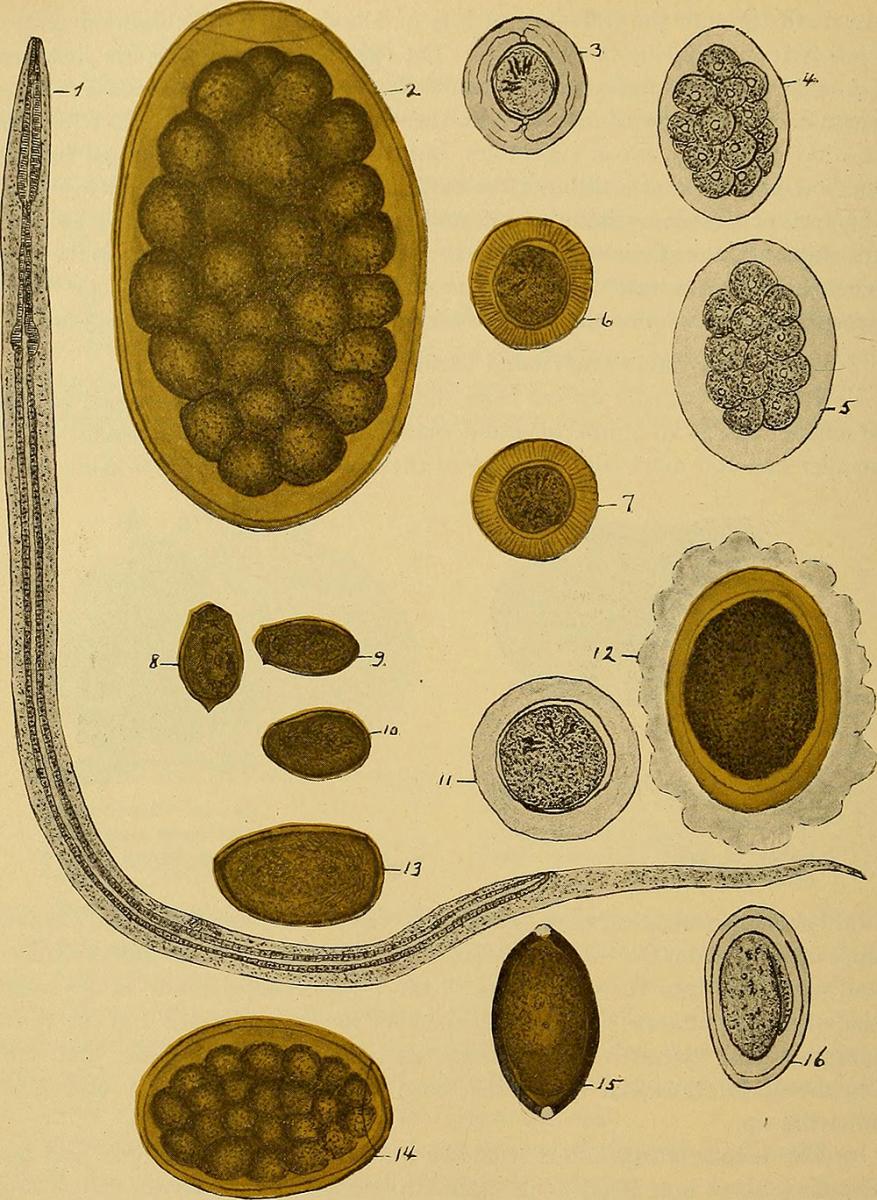 Medical Illustration of uncinaria Americana. Illustration originally published in Diagnostic methods, chemical, bacteriological and microscopical: a text-book for students and practitioners (Philadelphia: P. Blakiston's Son & Co., 1909), 192. Image uploaded by Flickr user Internet Archive Book Images. Image is in public domain. Medical Illustration of uncinaria Americana. Illustration originally published in Diagnostic methods, chemical, bacteriological and microscopical: a text-book for students and practitioners (Philadelphia: P. Blakiston's Son & Co., 1909), 192. Image uploaded by Flickr user Internet Archive Book Images. Image is in public domain.