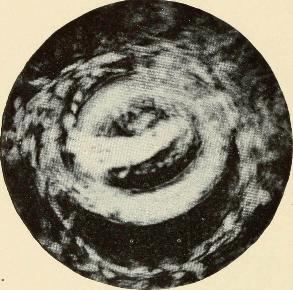 The Activity of the Larva of Nectoramericanus, Puerto Rico, 1911. Originally published in Bailey K. Ashford and Pedro Guitérrez Igaravidez's Uncinariasis (Hookworm disease) in Porto Rico: a medical and economic problem (Washington DC: US Government Print Office, 1911), 159. Photograph uploaded by Flickr user Internet Archive Book Images. Image is in public domain. The Activity of the Larva of Nectoramericanus, Puerto Rico, 1911. Originally published in Bailey K. Ashford and Pedro Guitérrez Igaravidez's Uncinariasis (Hookworm disease) in Porto Rico: a medical and economic problem (Washington DC: US Government Print Office, 1911), 159. Photograph uploaded by Flickr user Internet Archive Book Images. Image is in public domain.