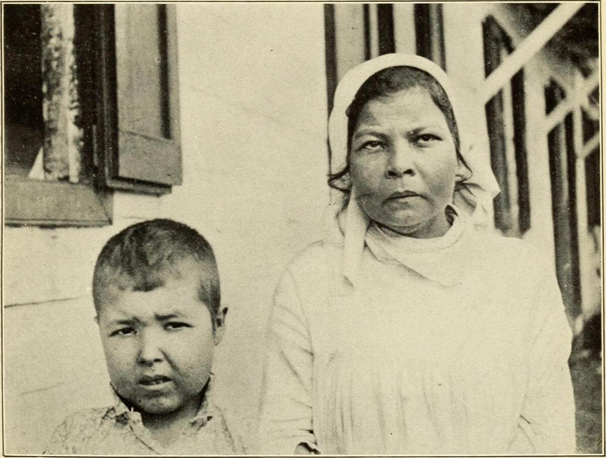 Typical Facial Expression of the Sufferers, Puerto Rico, 1911. Originally published in Bailey K. Ashford and Pedro Guitérrez Igaravidez's Uncinariasis (Hookworm disease) in Porto Rico: a medical and economic problem (Washington DC: US Government Print Office, 1911). Photograph uploaded by Flickr user Internet Archive Book Images. Image is in public domain. Typical Facial Expression of the Sufferers, Puerto Rico, 1911. Originally published in Bailey K. Ashford and Pedro Guitérrez Igaravidez's Uncinariasis (Hookworm disease) in Porto Rico: a medical and economic problem (Washington DC: US Government Print Office, 1911). Photograph uploaded by Flickr user Internet Archive Book Images. Image is in public domain.
