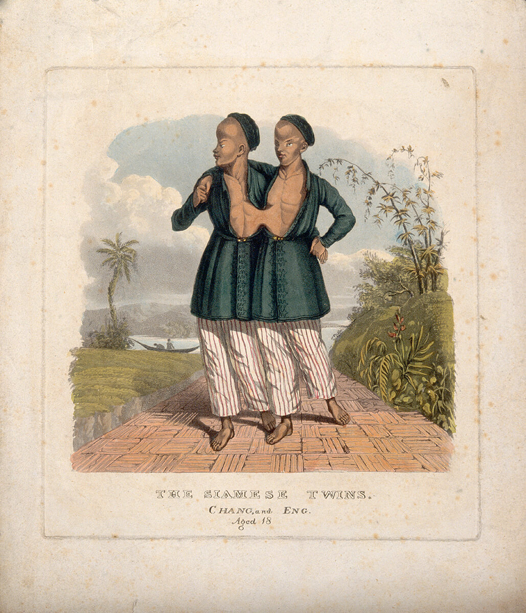 The Siamese twins, Chang and Eng, Aged 18. Aquatint with etching and watercolor by unknown creator. Courtesy of the Wellcome Collection. Creative Commons license CC BY 4.0. The Siamese twins, Chang and Eng, Aged 18. Aquatint with etching and watercolor by unknown creator. Courtesy of the Wellcome Collection. Creative Commons license CC BY 4.0.