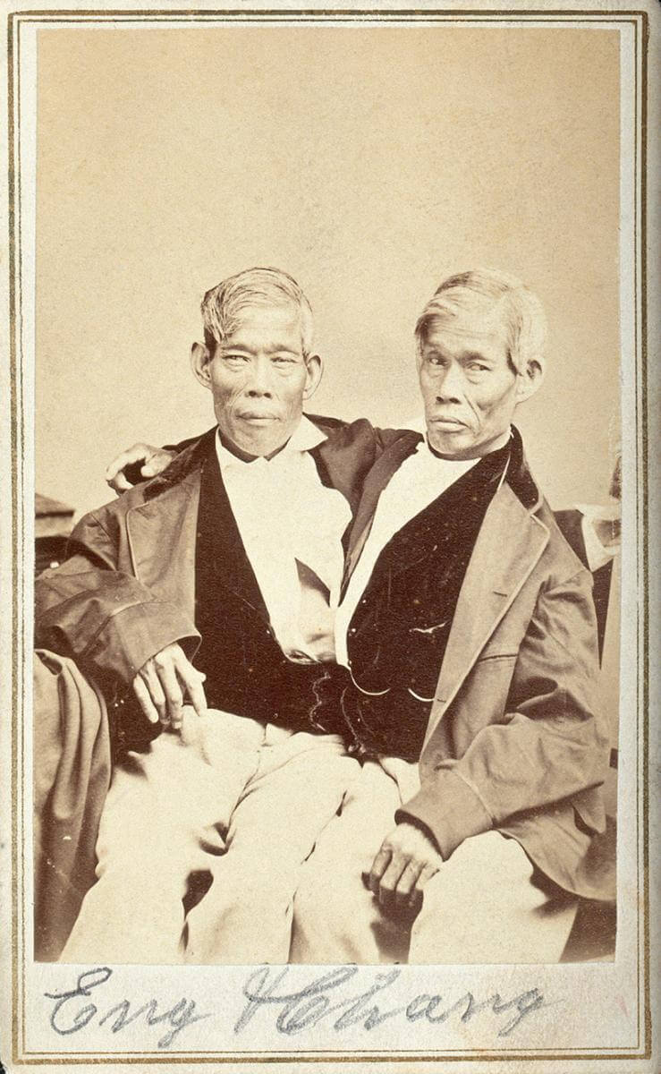 Eng and Chang. Photograph by unknown creator. Courtesy of the Wellcome Collection. Creative Commons license CC BY 4.0. Eng and Chang. Photograph by unknown creator. Courtesy of the Wellcome Collection. Creative Commons license CC BY 4.0.