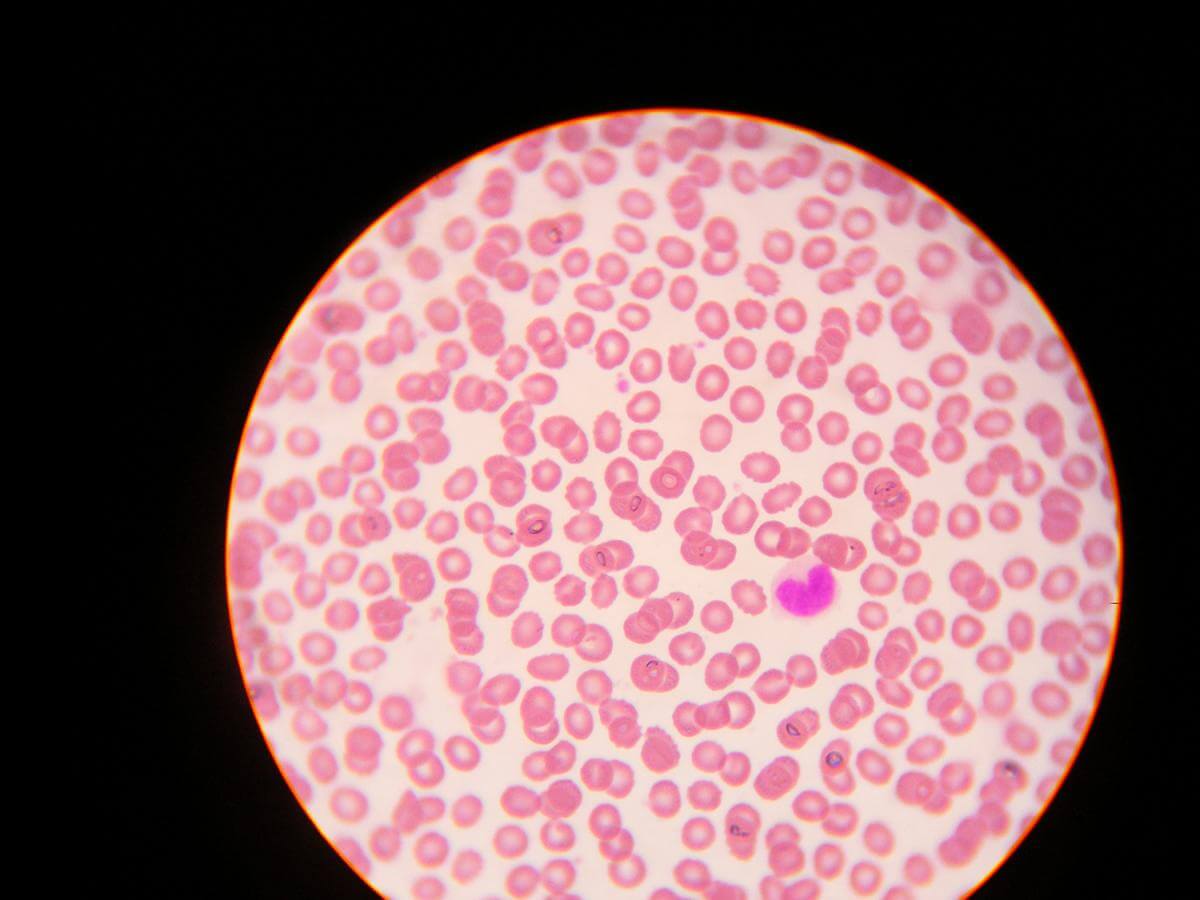 Microscopic image of a white blood cell in formation. Image courtesy of Flickr user Meowlody. Creative Commons license CC BY 2.0. Microscopic image of a white blood cell in formation. Image courtesy of Flickr user Meowlody. Creative Commons license CC BY 2.0.